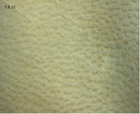 Calf follicle pattern (Q38 f.2r, BL f.8r)